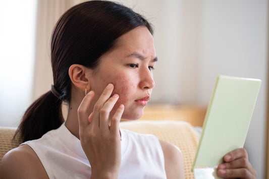 Why Natural Skincare Matters: What You’re Really Putting on Your Skin